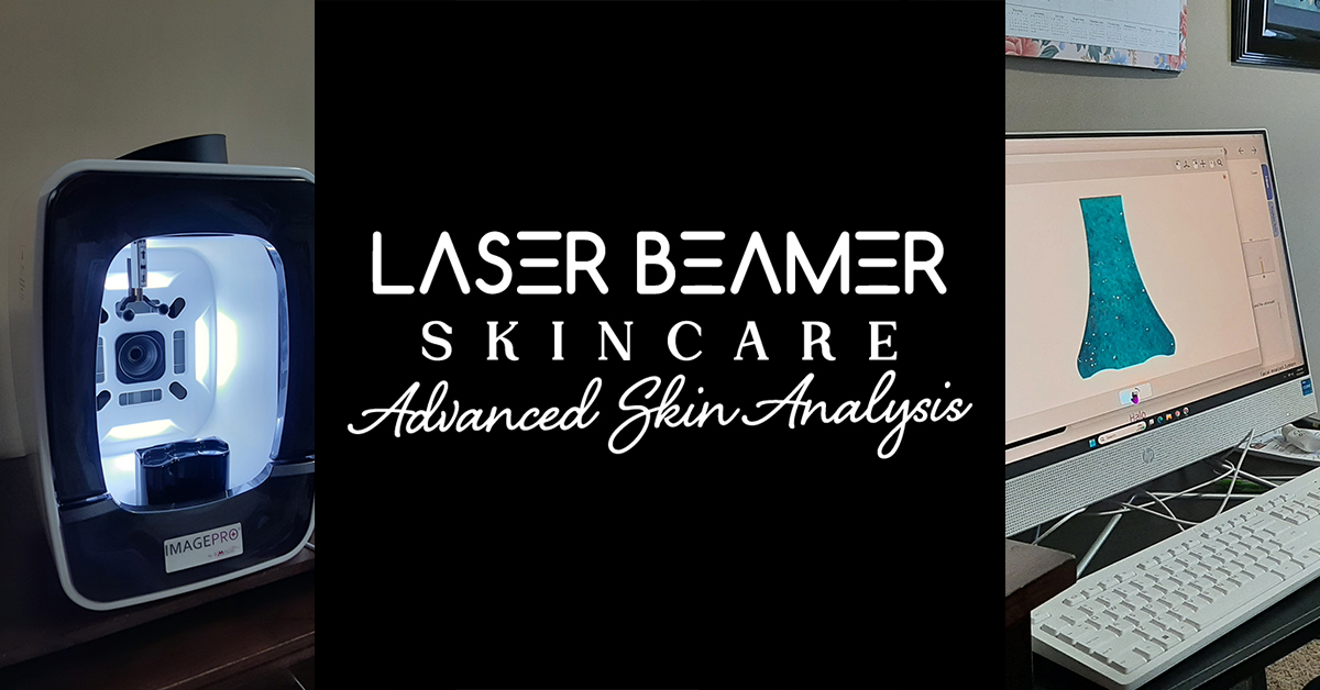 Advanced Skin Analysis at Laser Beamer Skincare only with the ImagePro Halo 3D Skin Analyzer