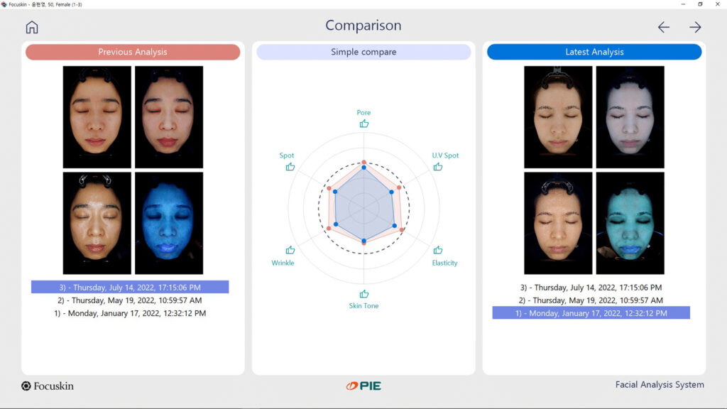ImagePro-Halo-Skin-Analysis-Results ImagePro® Halo Skin Analysis Results