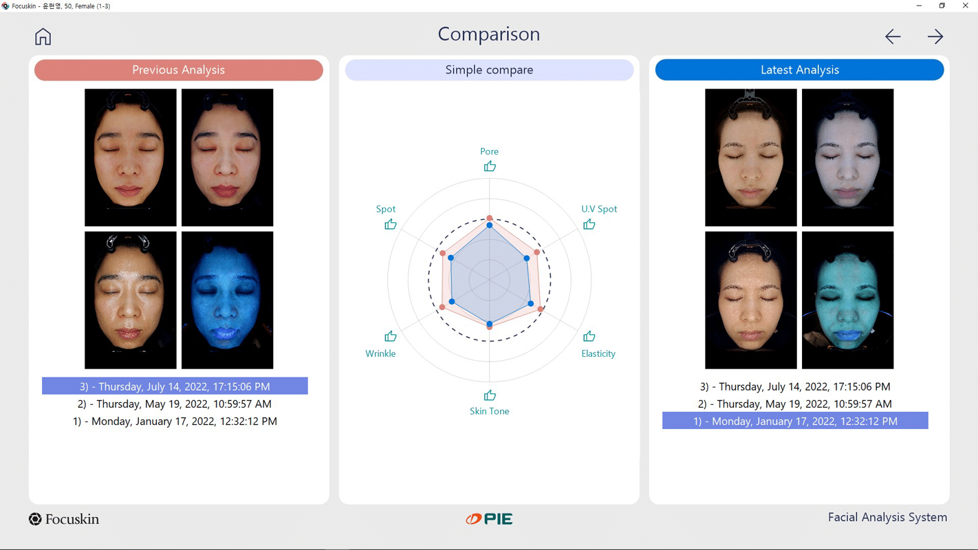 ImagePro® Halo Skin Analysis Results