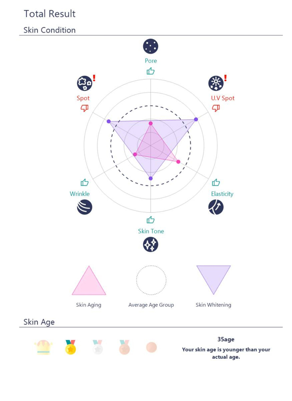 Results from the skin analyzer machine at Laser Beamer Skincare please note that results vary from customer to customer