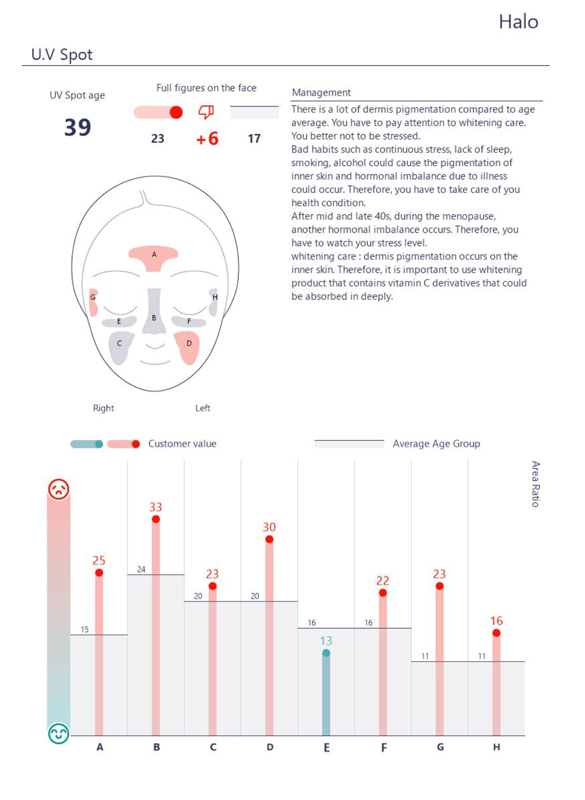 Results from the skin analyzer machine at Laser Beamer Skincare please note that results vary from customer to customer