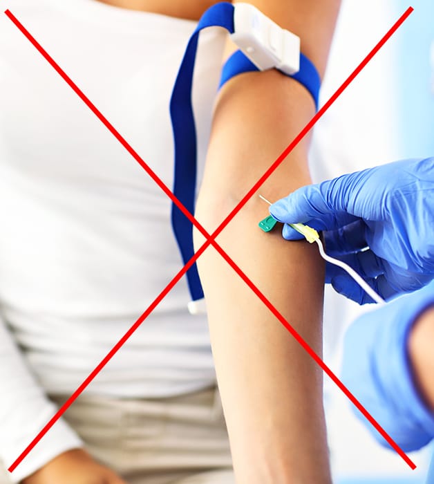 Blood draws are not necessary when you get microneedling from Laser Beamer Skincare with our Micro Needling + XO service