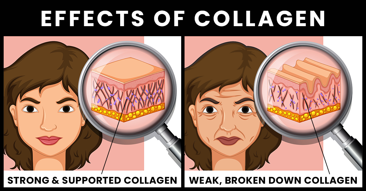 How collagen affects your skin and what you can do to help